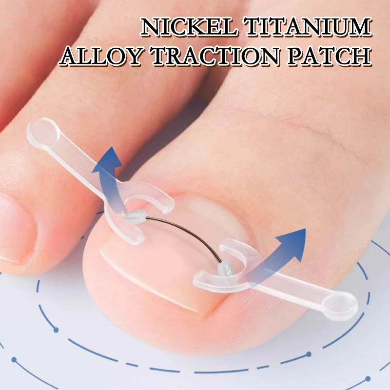 Ingrown Toenail Corrector 12/14/16/18mm Ingrown Toe Nail Treatment Elastic Patch Sticker Straightening Clip Brace Pedicure Tool