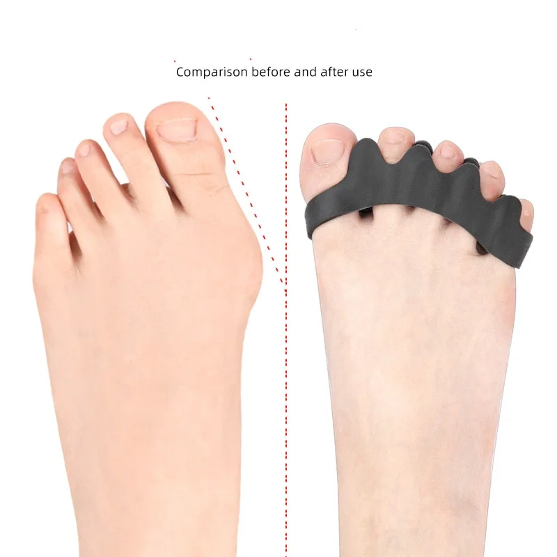 Forefoot Pad Five-hole Toe Separator For Hallux Valgus Big Toe Bone Overlap Toe Clamp Orthopedics Toe Separator Pad Adjustable thumbnail 3