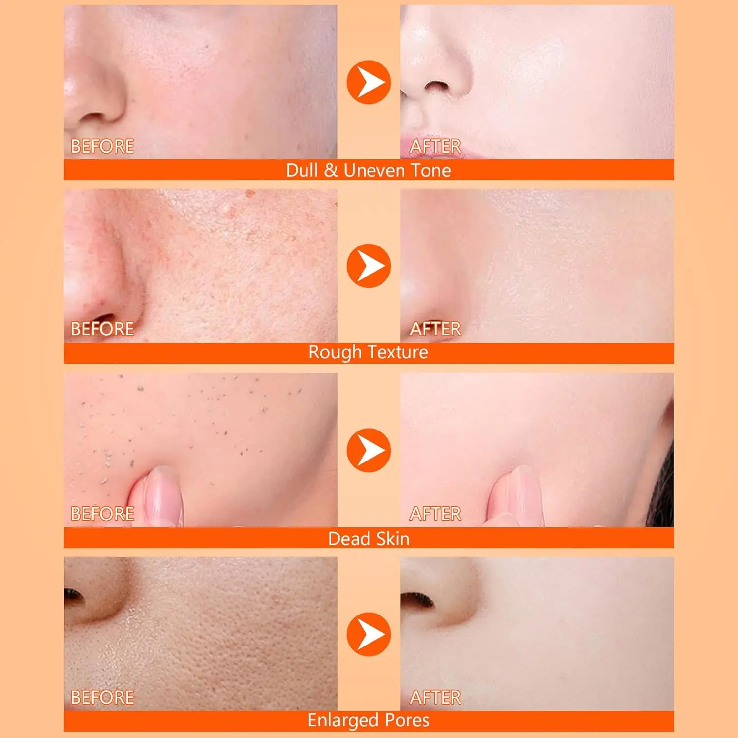 Body Keratin Care Kojic Acid Turmeric Spray Gently Exfoliating Peeling Solution Nourishing Hydrating Skin Care All Skin Types thumbnail 5