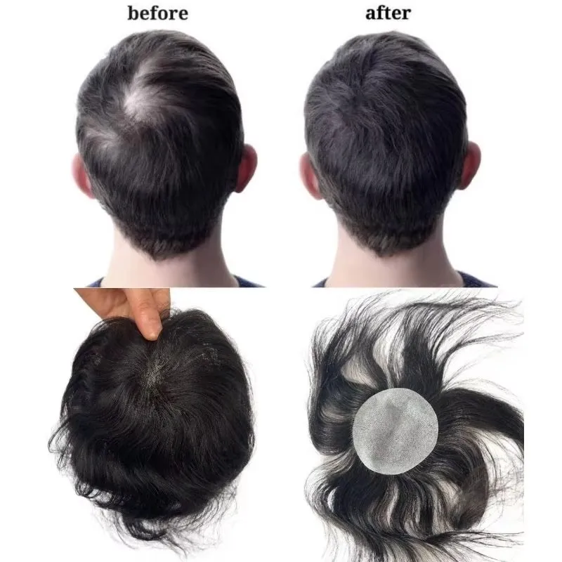 Thin Skin PU Bald Spot European Hair Patches Toupee for Men Dia. 8cm Hair Piece Glue On Hair Replacement System