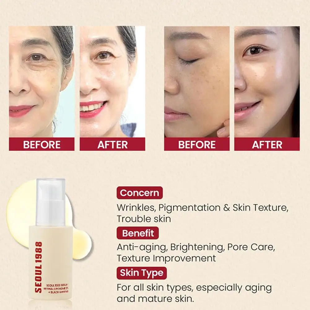 Korean SEOUL 1988 Moisturizing Serum Niacinamide Sunscreen Snail Cream Black Gingeng Extract Glow Face Serum Improve Skin Care thumbnail 6