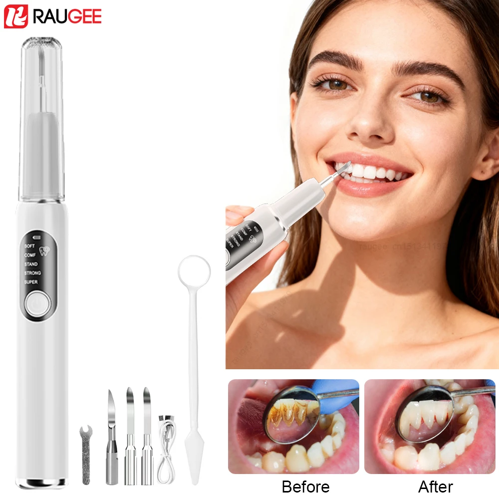 Ultrasonic Dental Scaler Electric Teeth Cleaner Teeth Stone Remover Calculus Plaque Tartar Removal Teeth Whitening Oral Care