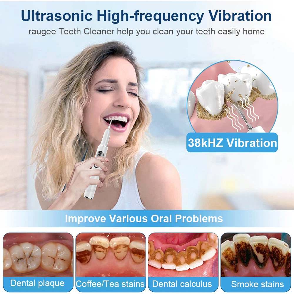 Ultrasonic Dental Scaler Electric Teeth Cleaner Teeth Stone Remover Calculus Plaque Tartar Removal Teeth Whitening Oral Care thumbnail 2