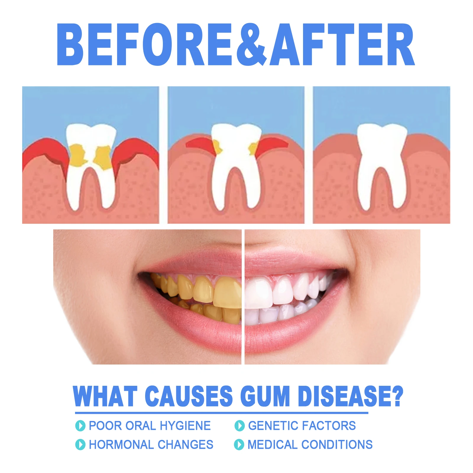 Damaged Gum Repair Care Gel Deep Cleaning Effectively Removes Yellow Teeth Stains Tartar Fresh Breath Teeth Cleaning Gel 4ml thumbnail 5