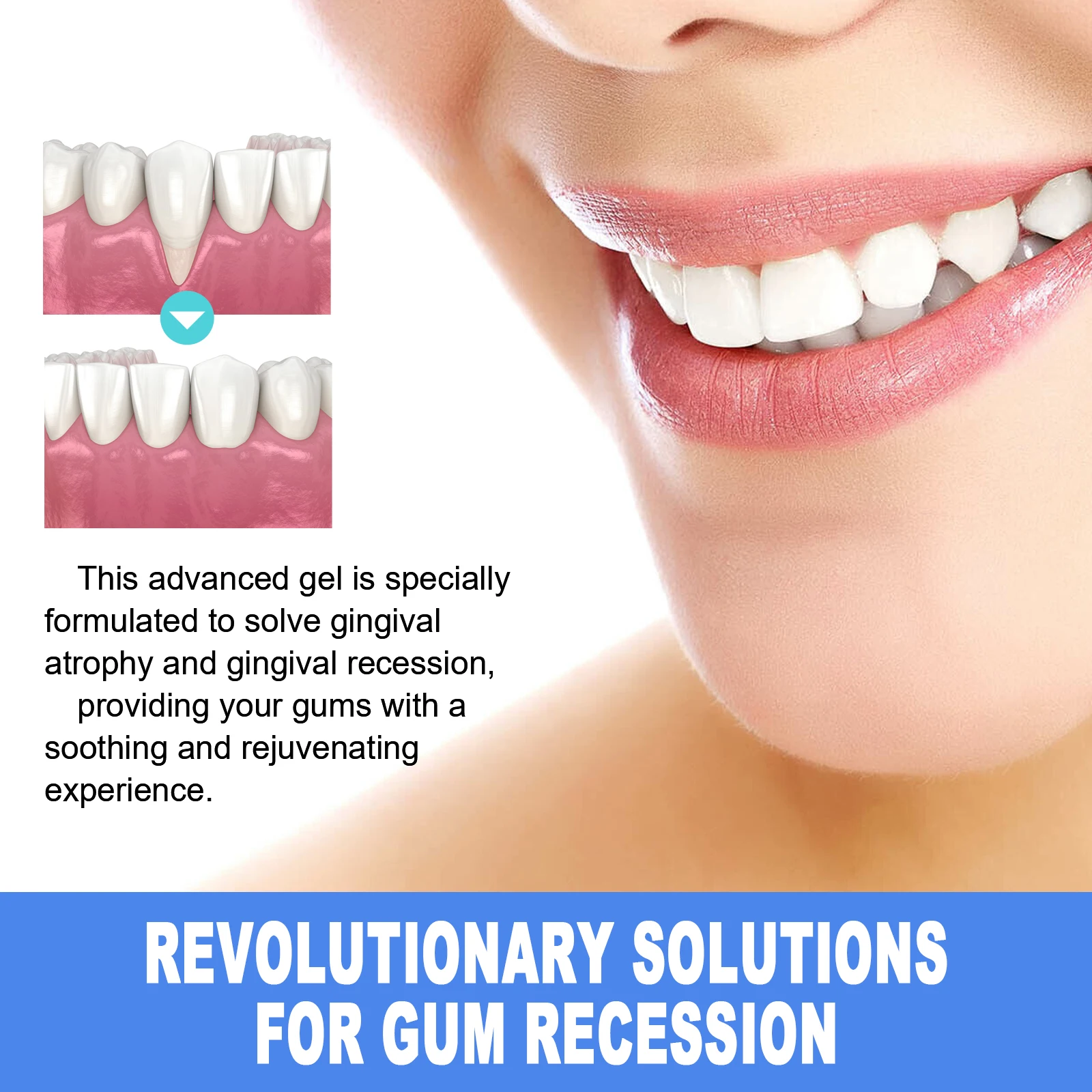 Damaged Gum Repair Care Gel Deep Cleaning Effectively Removes Yellow Teeth Stains Tartar Fresh Breath Teeth Cleaning Gel 4ml thumbnail 4