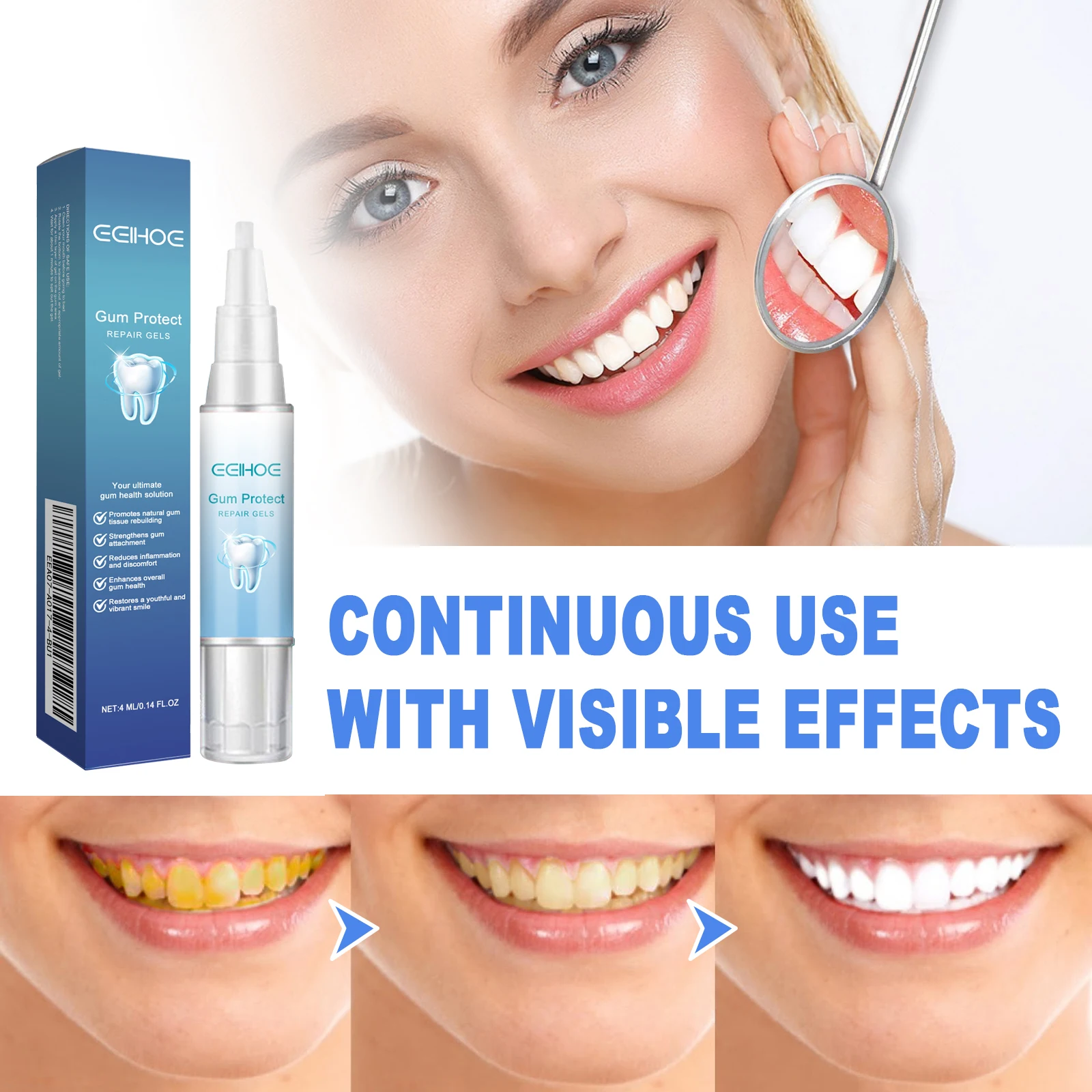 Damaged Gum Repair Care Gel Deep Cleaning Effectively Removes Yellow Teeth Stains Tartar Fresh Breath Teeth Cleaning Gel 4ml thumbnail 2