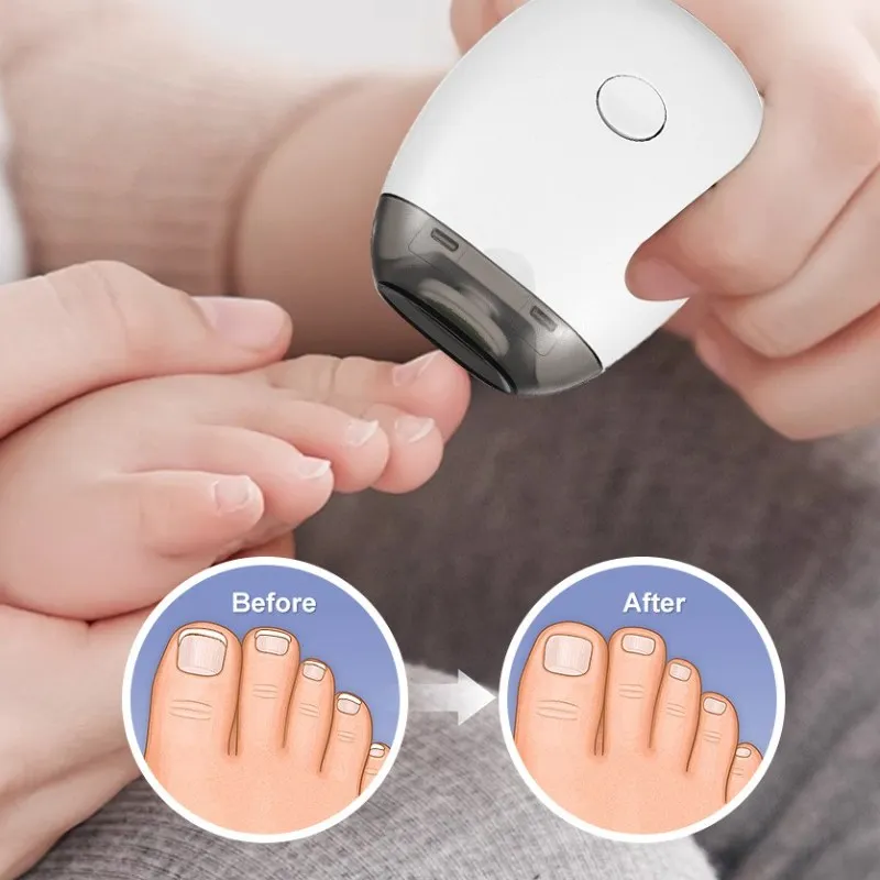 Electric Nail Trimmer Rechargeable Pain-Free Technology Automatic Fingernail & Toenail Clipper with LED Light Grinding Head Port thumbnail 3