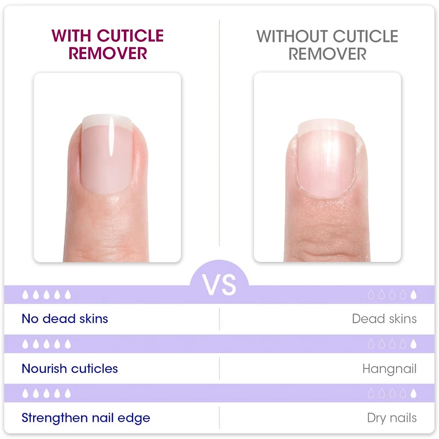 QAZIXU 10ml Nail Care Cuticle Remover Nail Polish for Dead Skin Gel Manicure Treatment Tool For Nail Art DIY Salon Home thumbnail 4