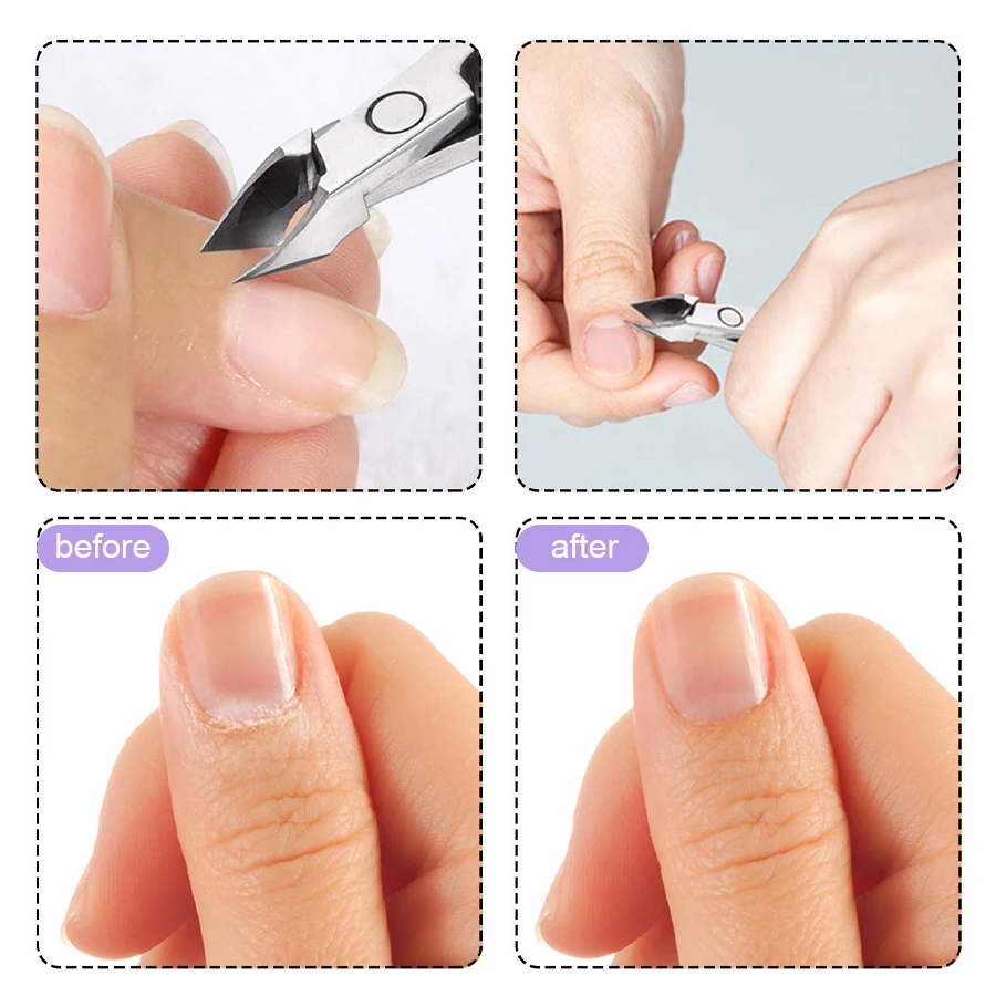 QAZIXU 10ml Nail Care Cuticle Remover Nail Polish for Dead Skin Gel Manicure Treatment Tool For Nail Art DIY Salon Home thumbnail 3