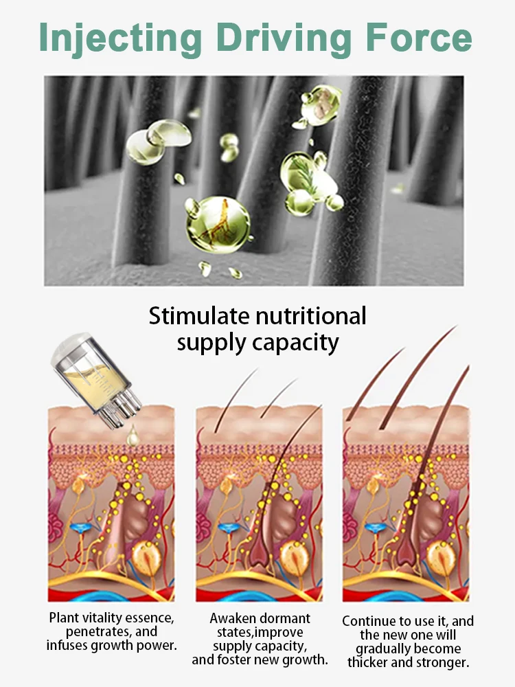 2025 nouvelle vente chaude applicateur de cuir chevelu rouleau de Massage brosse applicateur de cheveux combinaison thumbnail 5