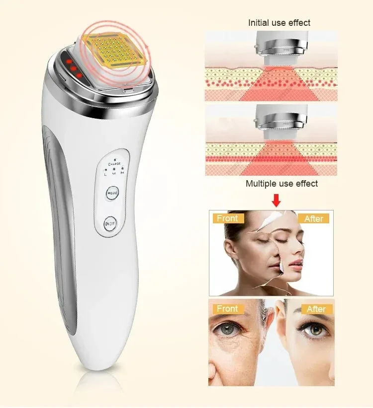 Electric Facial Lifting Machine Dot Matrix Skin Tightening Rejuvenation Wrinkle Removal Face Massager Home Use Beauty Devices thumbnail 3