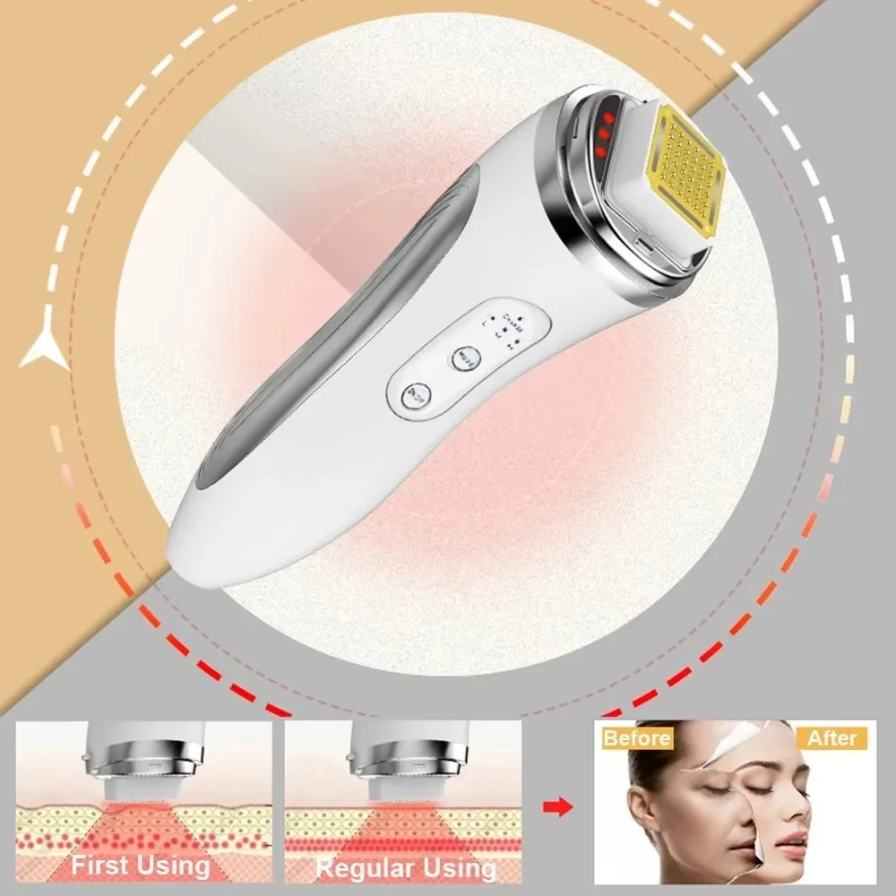 RF Radio Frequency Face Lifting Device Dot Matrix Beauty Massager Home Wrinkle Remover Skin Tightening Facial Massage Machine thumbnail 5