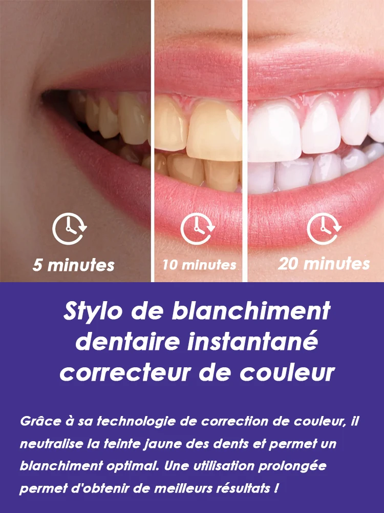 Purple instant teeth whitening pen cleans teeth stains without sensitivity, resulting in a brighter and whiter smile thumbnail 2