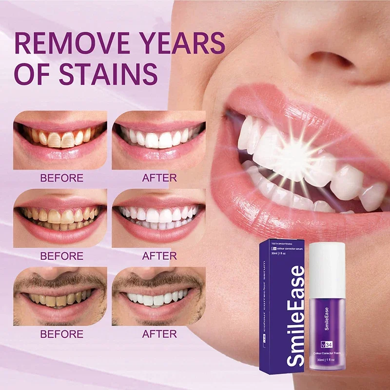 45ml Smilekit Purple Tooth Mousse Removes Tartar Clean Oral Hygiene 30ml Smileease Fresh Breath Whitening Teeth Care Products thumbnail 2