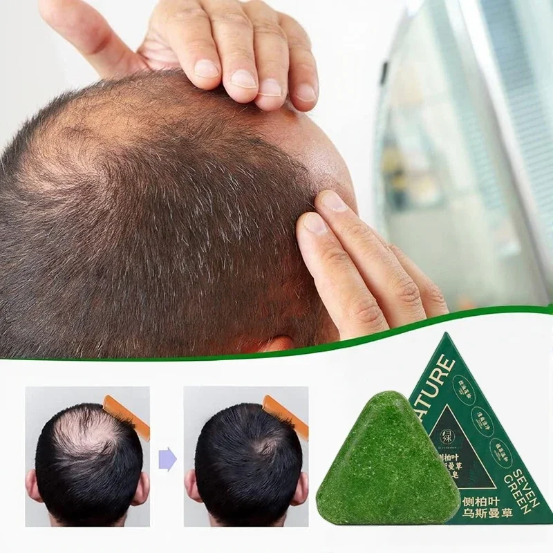 Oriental Arborvitae Leaf Shampoo Soap Relieves Scalp Itching Strengthens Hair Root Oil Control Anti-dandruff New Natural Shampoo thumbnail 4