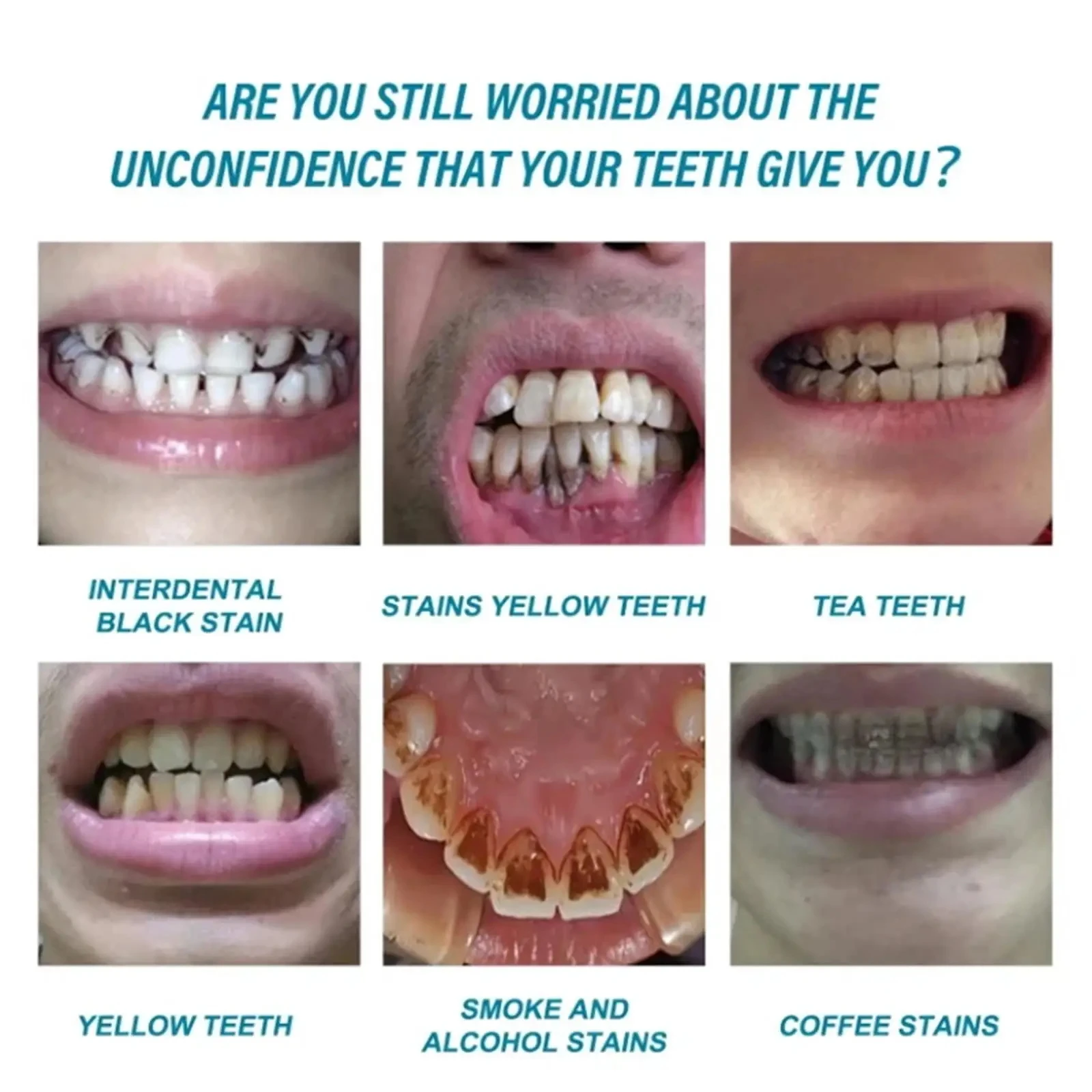 Tooth Whitening Essence Tooth Calculus Removing Dental Plaque Bad Breath Yellow Teeth Repairing Gums Teeth Cleaning Toothpaste thumbnail 5