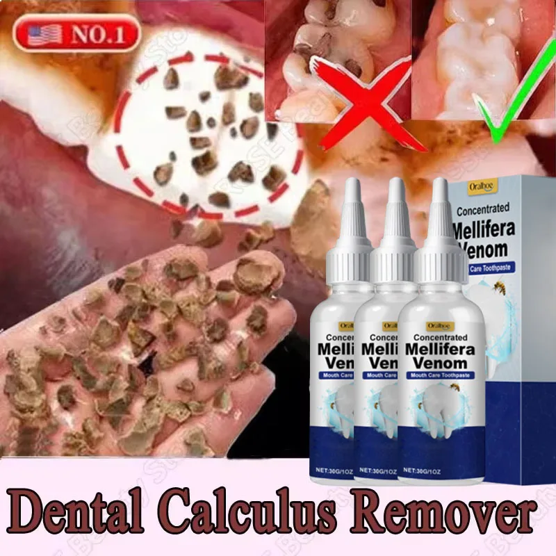 Tooth Whitening Essence Tooth Calculus Removing Dental Plaque Bad Breath Yellow Teeth Repairing Gums Teeth Cleaning Toothpaste