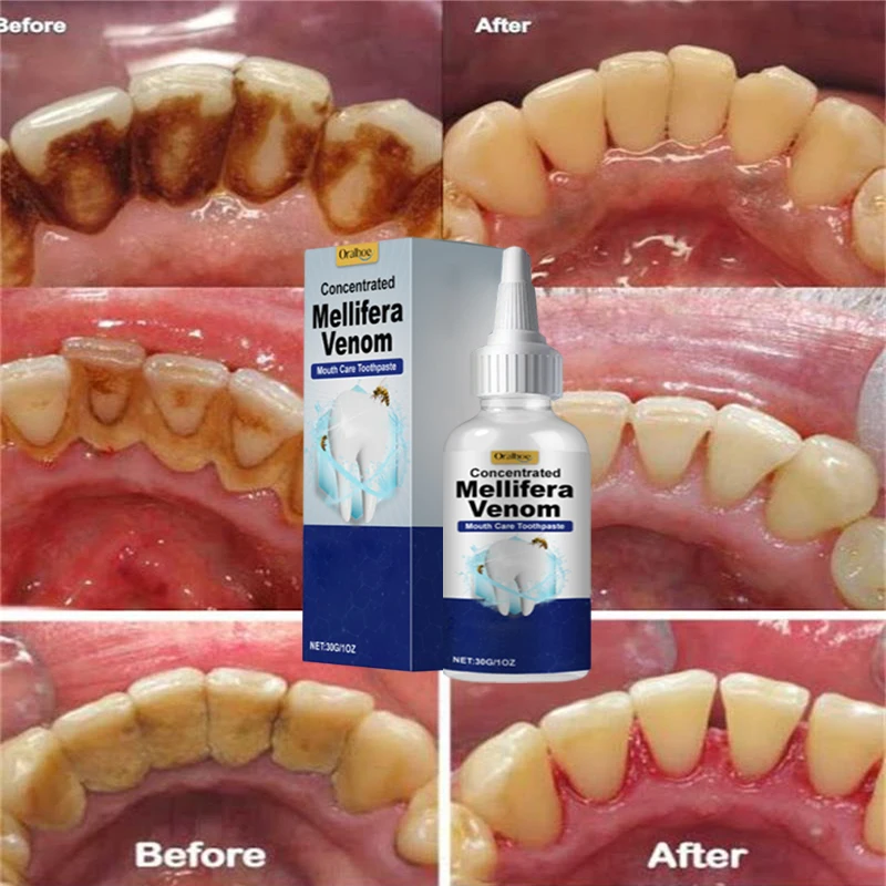 Tooth Whitening Essence Tooth Calculus Removing Dental Plaque Bad Breath Yellow Teeth Repairing Gums Teeth Cleaning Toothpaste thumbnail 4