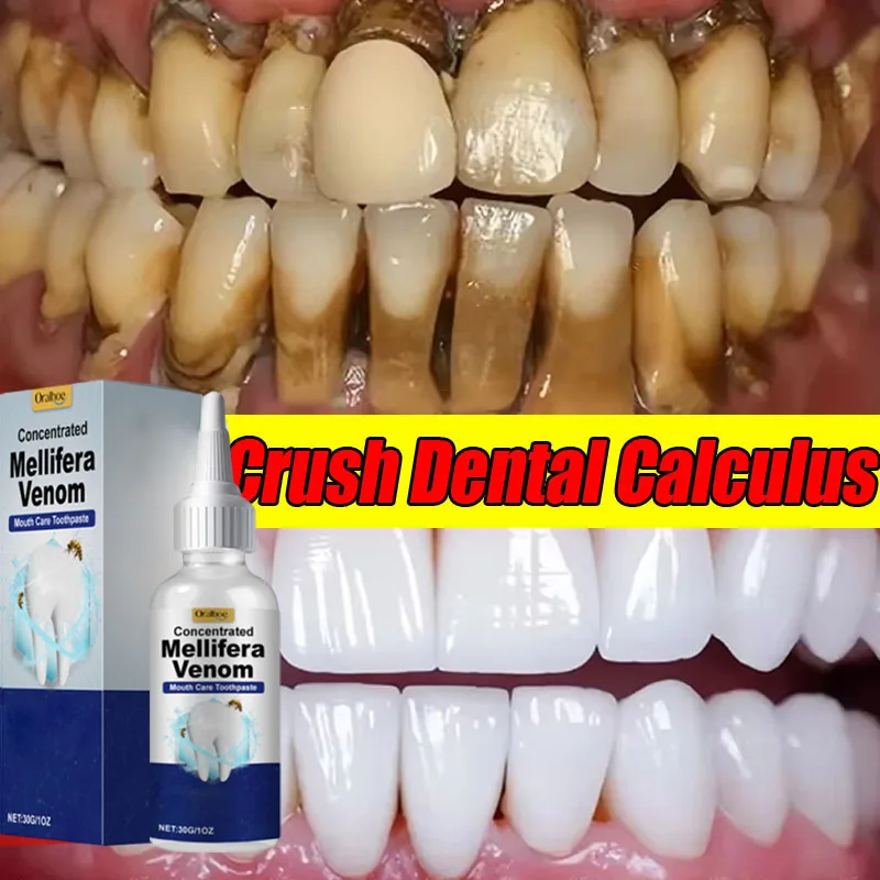 Tooth Whitening Essence Tooth Calculus Removing Dental Plaque Bad Breath Yellow Teeth Repairing Gums Teeth Cleaning Toothpaste thumbnail 3