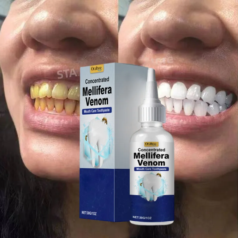 Tooth Whitening Essence Tooth Calculus Removing Dental Plaque Bad Breath Yellow Teeth Repairing Gums Teeth Cleaning Toothpaste thumbnail 2