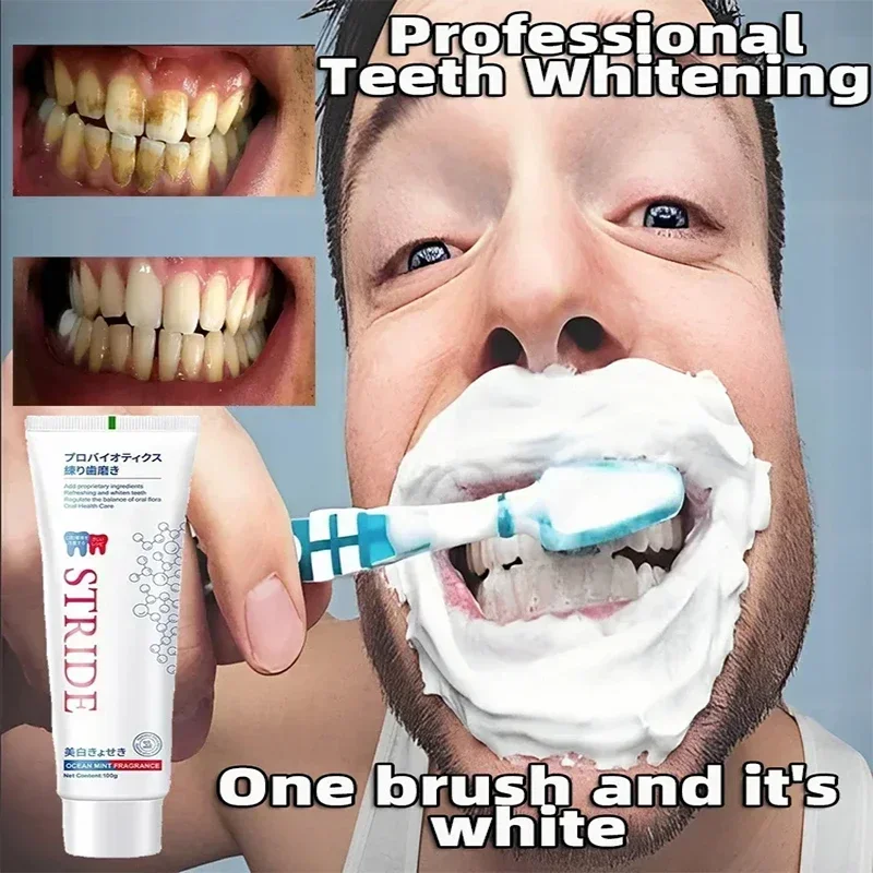 Toothpaste Dental Calculus Remover Whitening Removal Bad Breath Teeth Brightening Preventing Periodontitis Dental Cleansing Care thumbnail 5