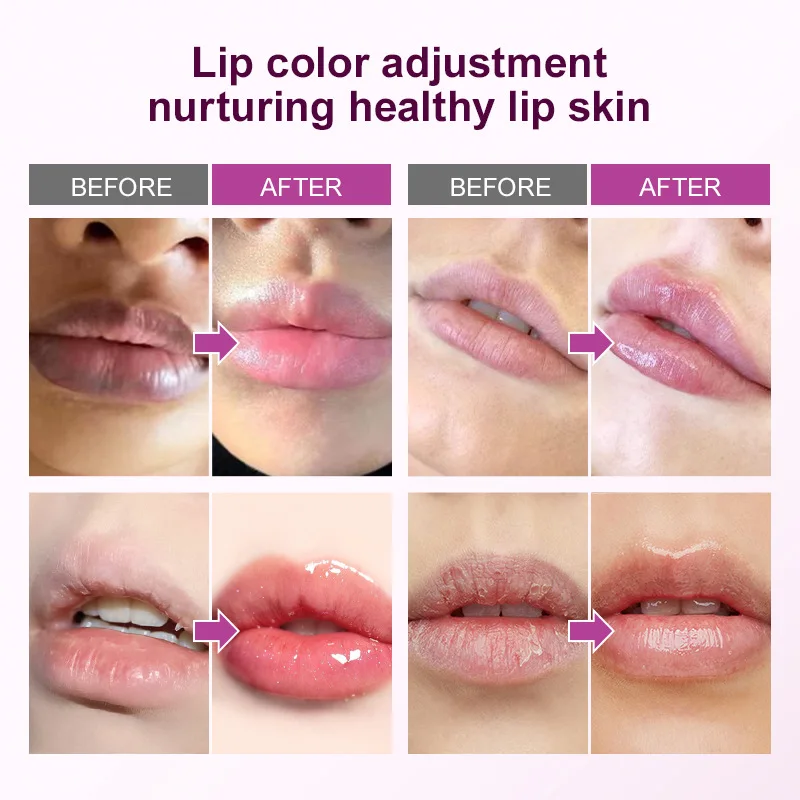 Remove Dark Lip Balm Fast Lightening Pink Lip Exfoliating Fade Lip Line Dead Skin Moisturizer Korean Care Products Beauty Health thumbnail 2