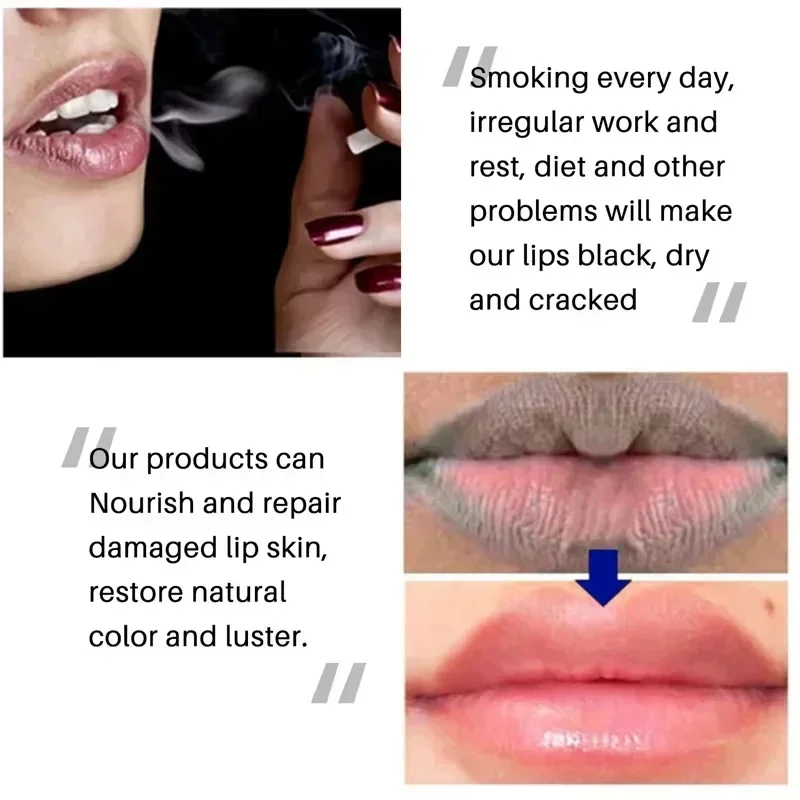 Remove Dark Lip Balm Fast Lightening Pink Lip Exfoliating Fade Lip Line Dead Skin Moisturizer Korean Care Products Beauty Health thumbnail 5