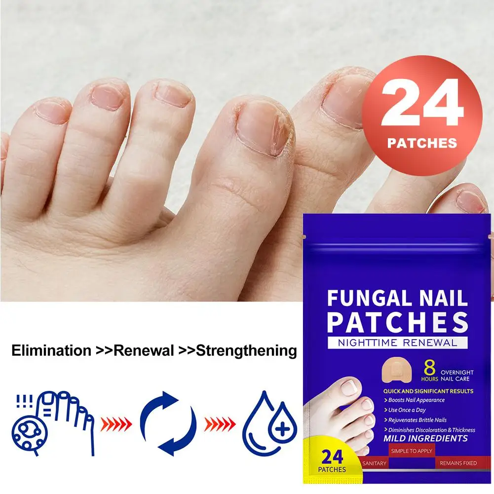 New Bags Toenail Fungus Patch Nail Repair Patches Nail Ingrown Correction Sticker Discolored Damaged Nails Foot Care Tool thumbnail 2