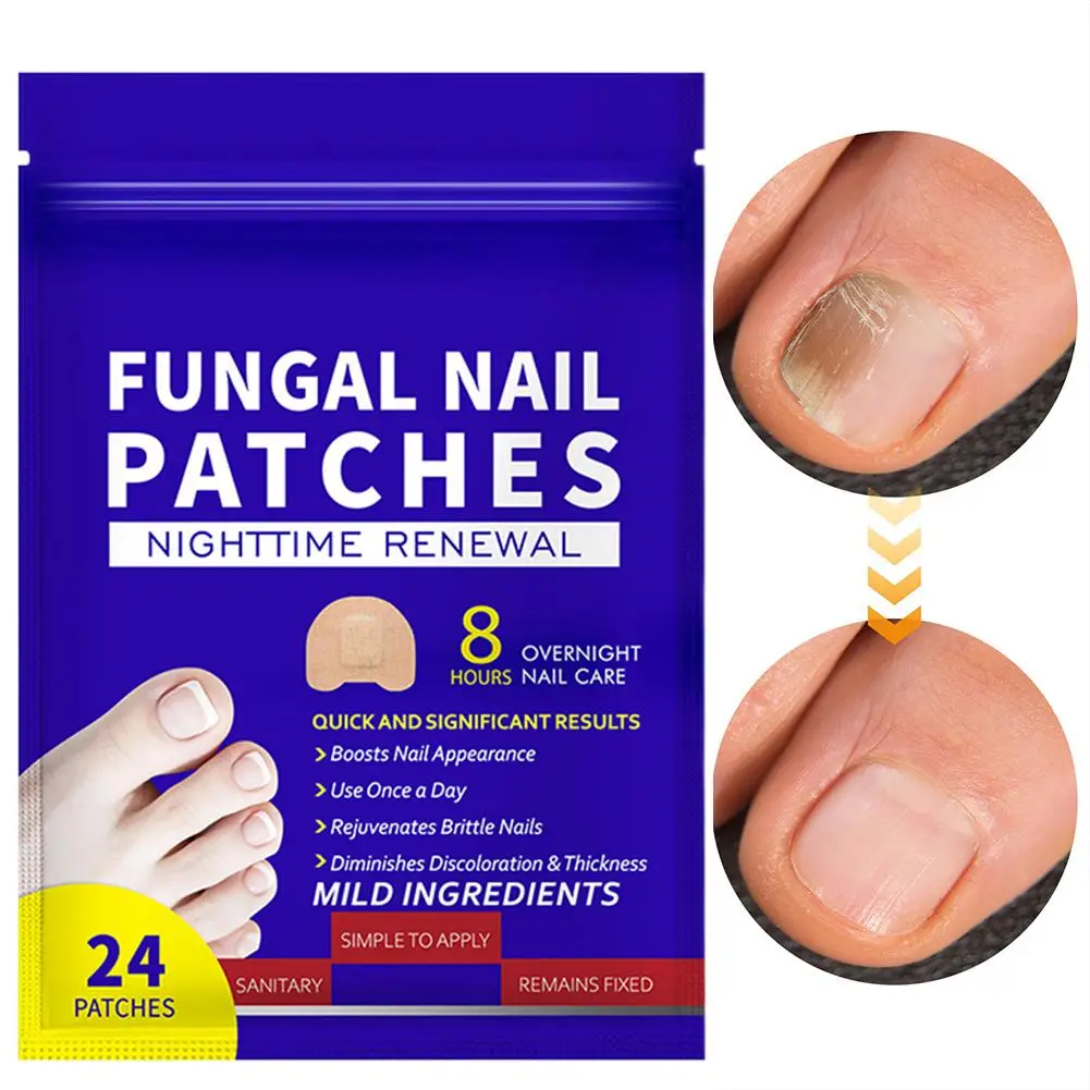 New Bags Toenail Fungus Patch Nail Repair Patches Nail Ingrown Correction Sticker Discolored Damaged Nails Foot Care Tool thumbnail 6