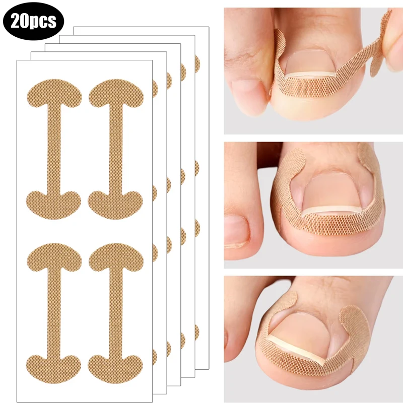 20-100pcs Adhesive Toenail Patch Ingrown Toe Nail Correction Sticker Foot Corrector Pedicure Health Care Tools Toe Treatment Pad thumbnail 2