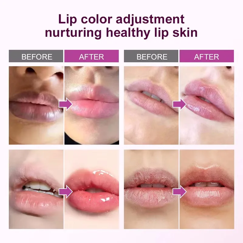 Remove Dark Lip Balm Fast Lightening Pink Lip Exfoliating Fade Lip Line Dead Skin Moisturizer Korean Care Products Beauty Health thumbnail 2