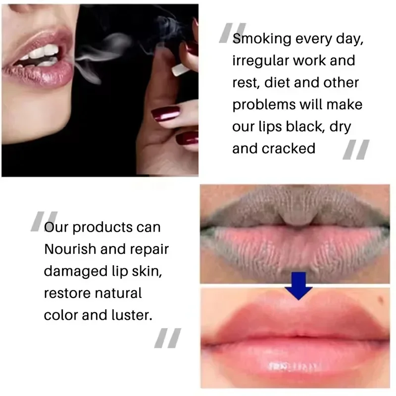 Remove Dark Lip Balm Fast Lightening Pink Lip Exfoliating Fade Lip Line Dead Skin Moisturizer Korean Care Products Beauty Health thumbnail 5
