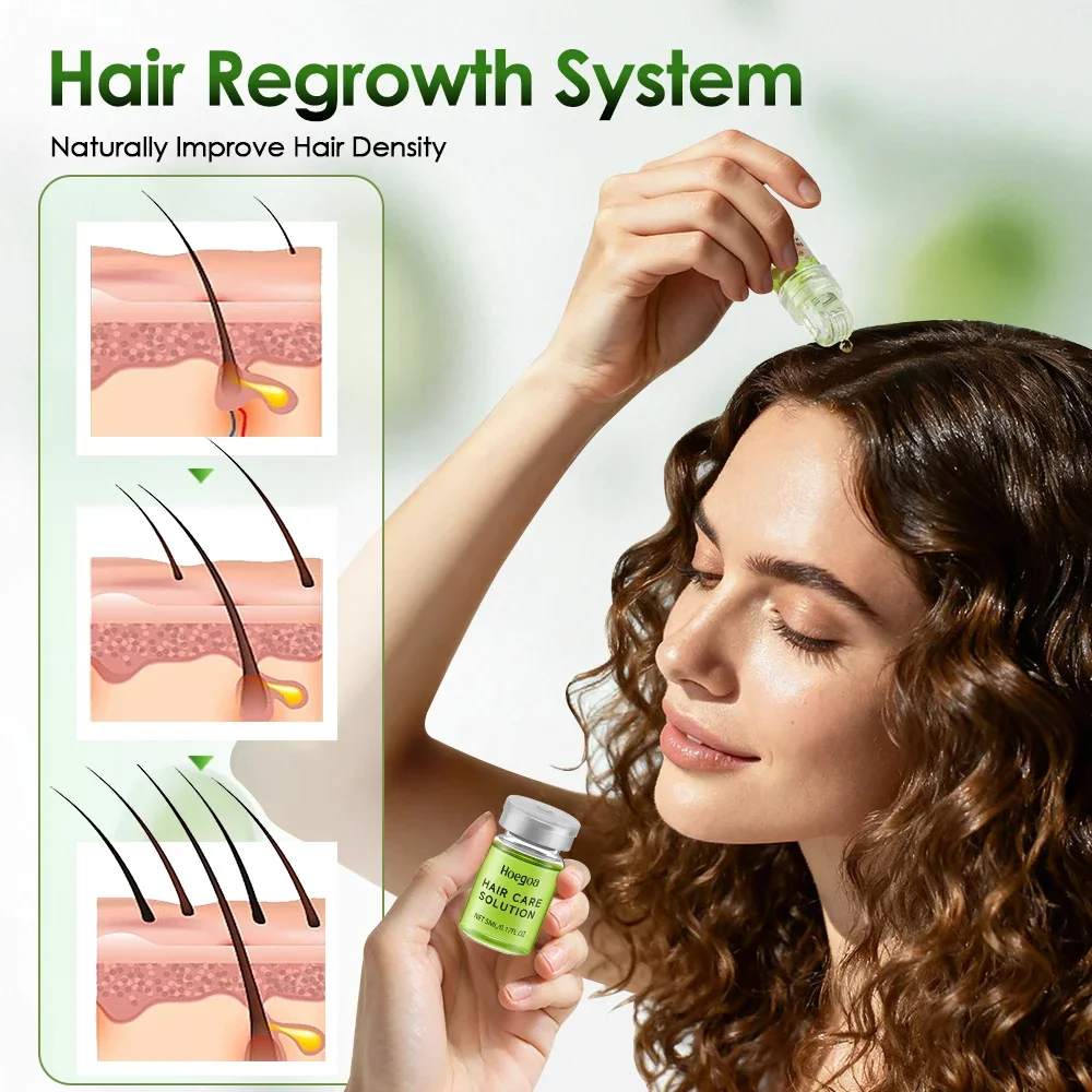 Hair Essential Care Serum Strengthen Roots Reducing Loss Prevent Baldness Nourish Scalp Hair Care Anti-Hair Loss Conditioner thumbnail 3