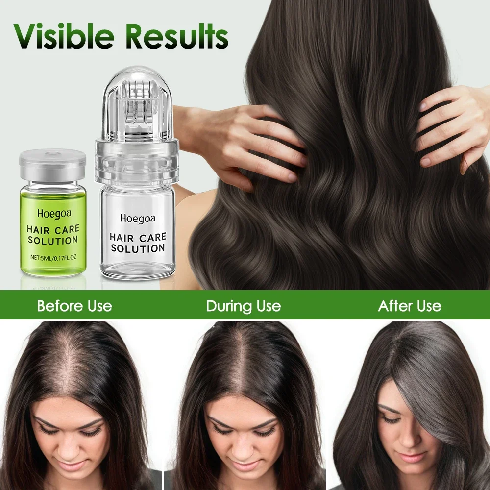 Hair Essential Care Serum Strengthen Roots Reducing Loss Prevent Baldness Nourish Scalp Hair Care Anti-Hair Loss Conditioner thumbnail 4