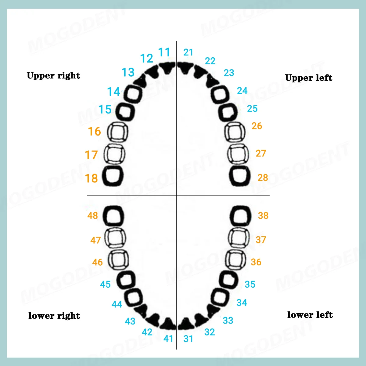 Dental Frasaco AG3 Type Model With Removable Teeth Dental Teeth Model Screwed-in Teeth 32Pcs Training Teach Demo thumbnail 6