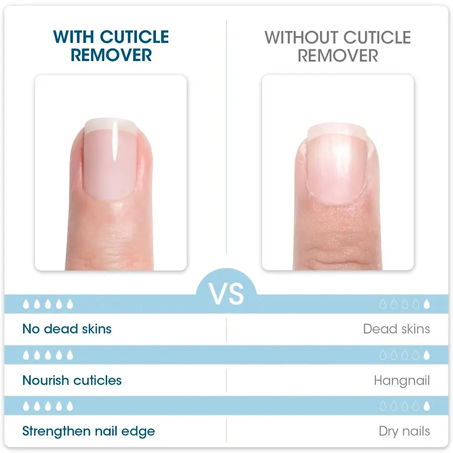 QAZIXU 10ml Nail Care Cuticle Remover Nail Polish for Dead Skin Gel Manicure Treatment Tool For Nail Art DIY Cleaner Tool thumbnail 6
