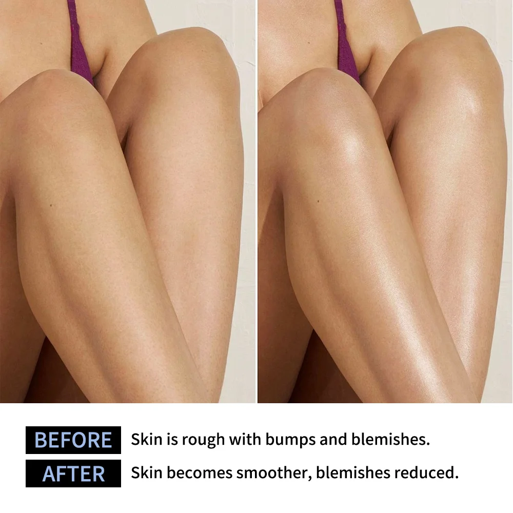 Lakerain Exfoliating Body Stick Multiple Glycolic Acid Cleaning Long-lasting Moisturizing Nourishing Smoothing Skin Care thumbnail 4