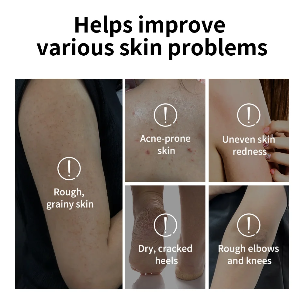 Lakerain Exfoliating Body Stick Multiple Glycolic Acid Cleaning Long-lasting Moisturizing Nourishing Smoothing Skin Care thumbnail 5