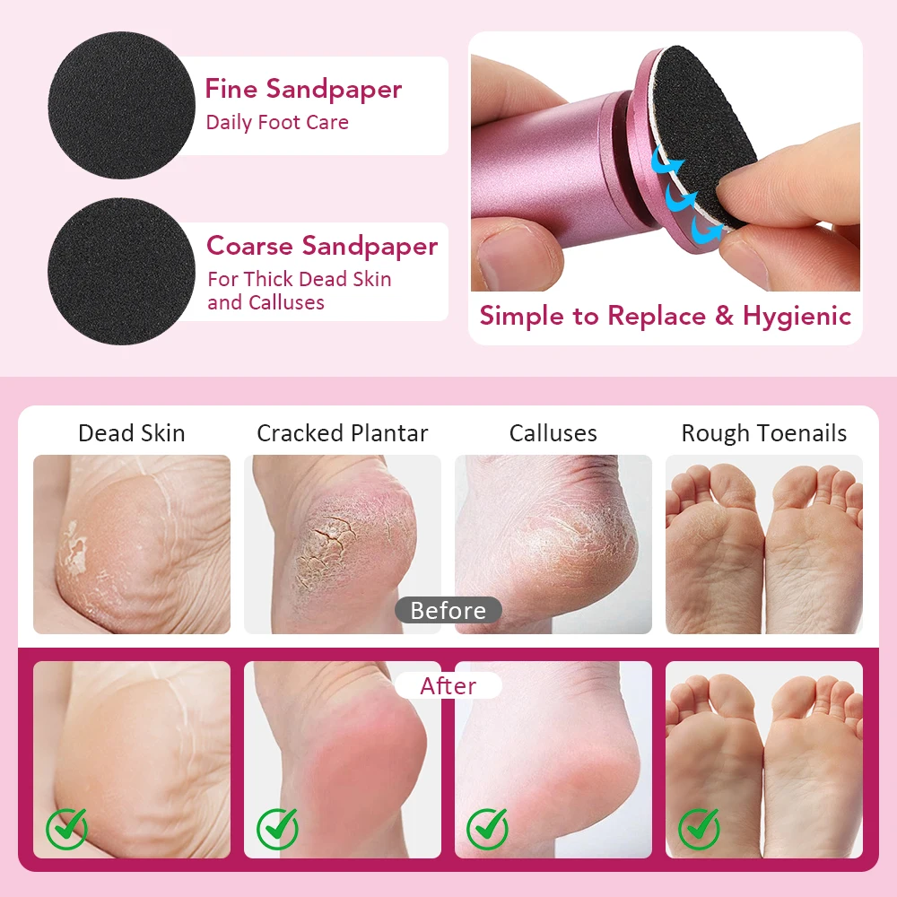 USB Electric Foot Callus Remover Foot Care Tool Leg Heels Remove Dead Skin Pedicure Tool Set With Replacement Sandpaper thumbnail 4