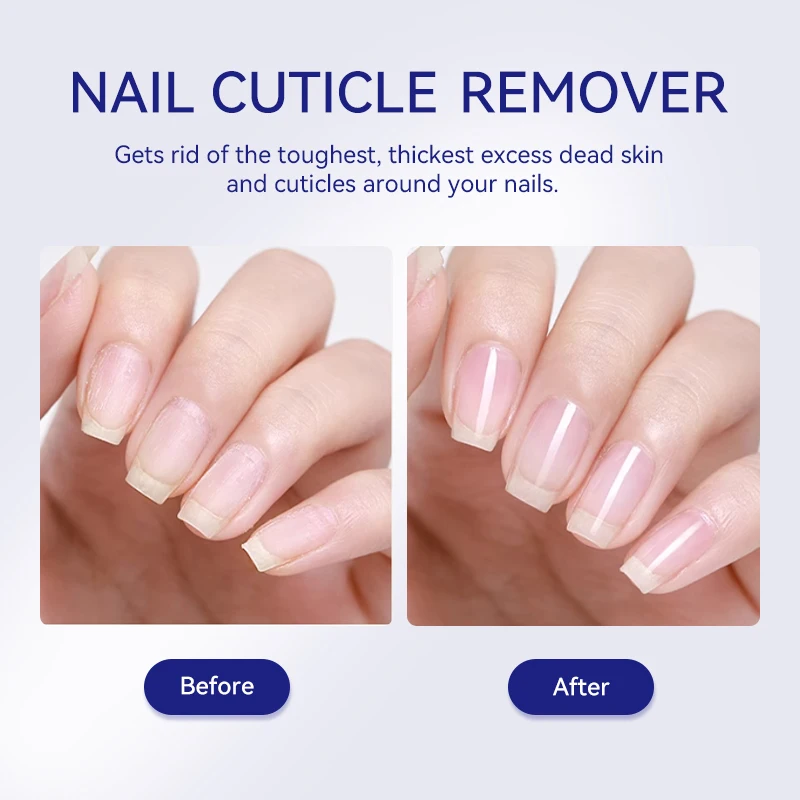 LILYCUTE 30ml Nail Cuticle Remover Quick Softening Gel For Nail Dead Skin Gentle Remover Manicure Care Easy Cuticle Cleaner Tool thumbnail 5