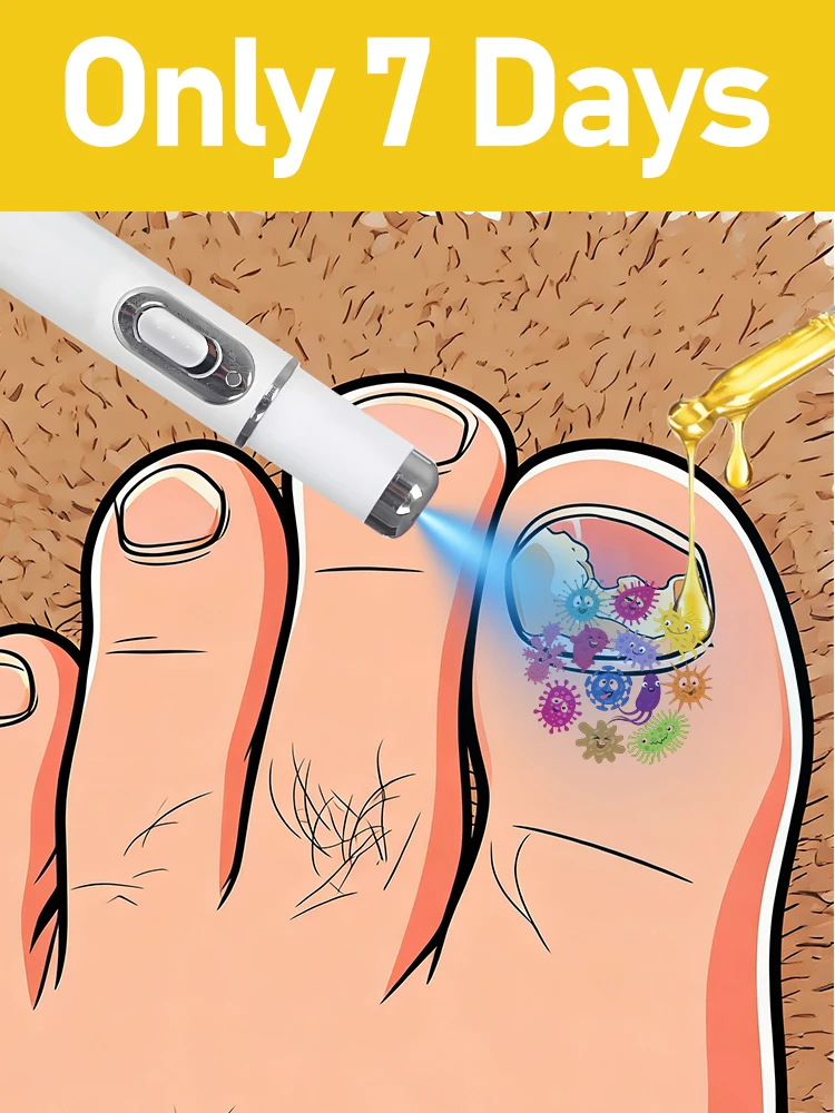 Generation-2,7 days helping people who for nail solve their problems,Hot sale