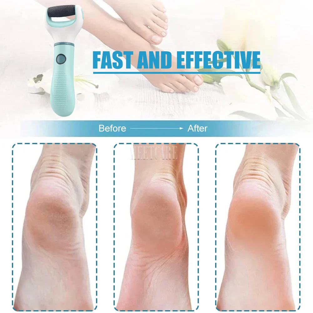 Electric Foot Grinder Dead Skin Remover Feet Scrubber Callus Pedicure Shaver Remove Dry Dead Cracked Foot Care Repair Tool thumbnail 5