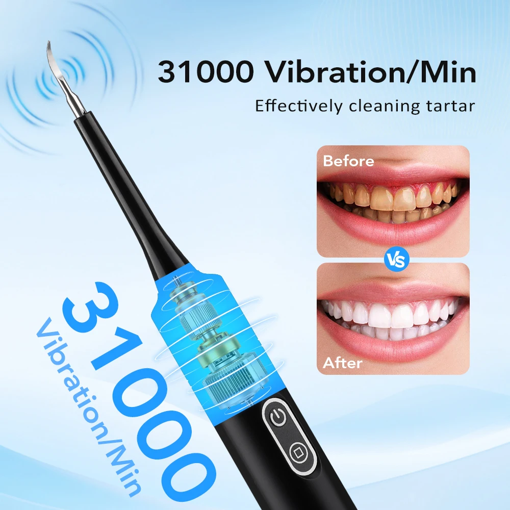 Electric Tooth Cleaner Dental Scaler Calculus Remover Sonic Vibration Toothbrush Plaque Tartar Removal Teeth Whitening Cleaning thumbnail 4
