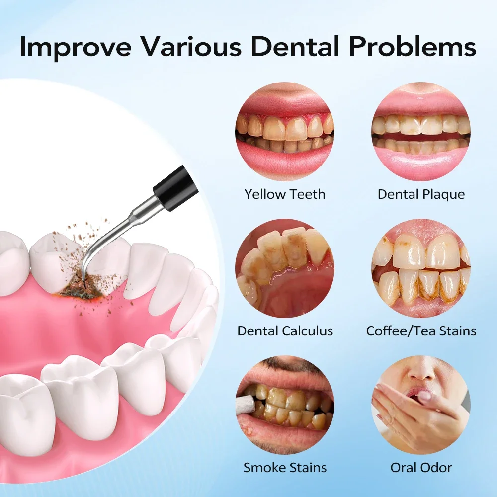 Electric Teeth Cleaner 5-gear Modes Portable Toothbrush Tartar Remover High Frequency Vibration Tartar Cleaning Whitening Teeth thumbnail 4