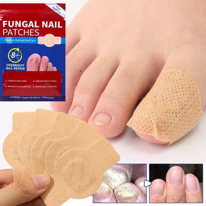 21/210pcs Waterproof Nail Fungus Correction Patch Finger Guard Bandage for Nail Fungus Hollow Nail Cover Disguise Patch thumbnail 2