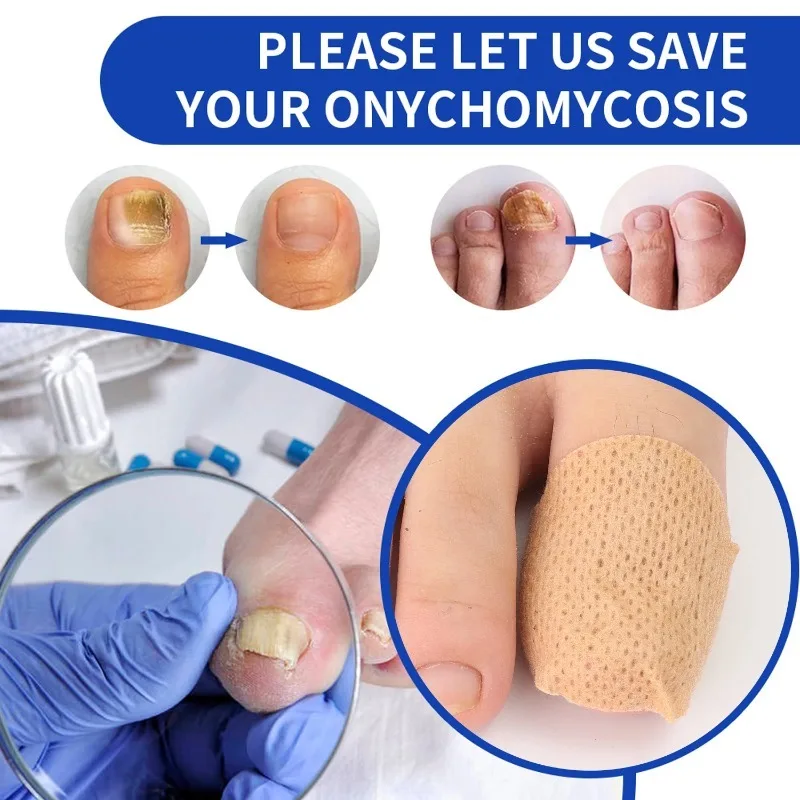 21/210pcs Waterproof Nail Fungus Correction Patch Finger Guard Bandage for Nail Fungus Hollow Nail Cover Disguise Patch thumbnail 6