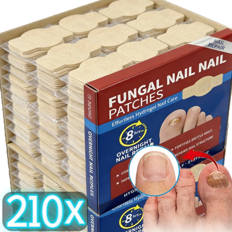 21/210PCS Nail Repair Patches Toenail Fungus Patch Sticky Care Nail Ingrown Correction Sticker Paronychia Disposable Toe Patch thumbnail 2