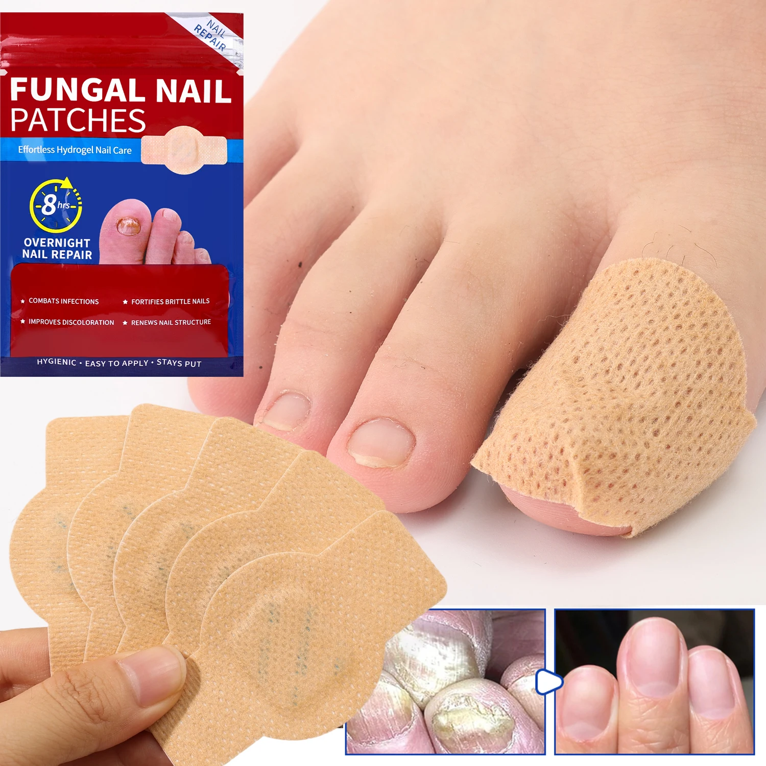 21/210PCS Nail Repair Patches Toenail Fungus Patch Sticky Care Nail Ingrown Correction Sticker Paronychia Disposable Toe Patch thumbnail 5