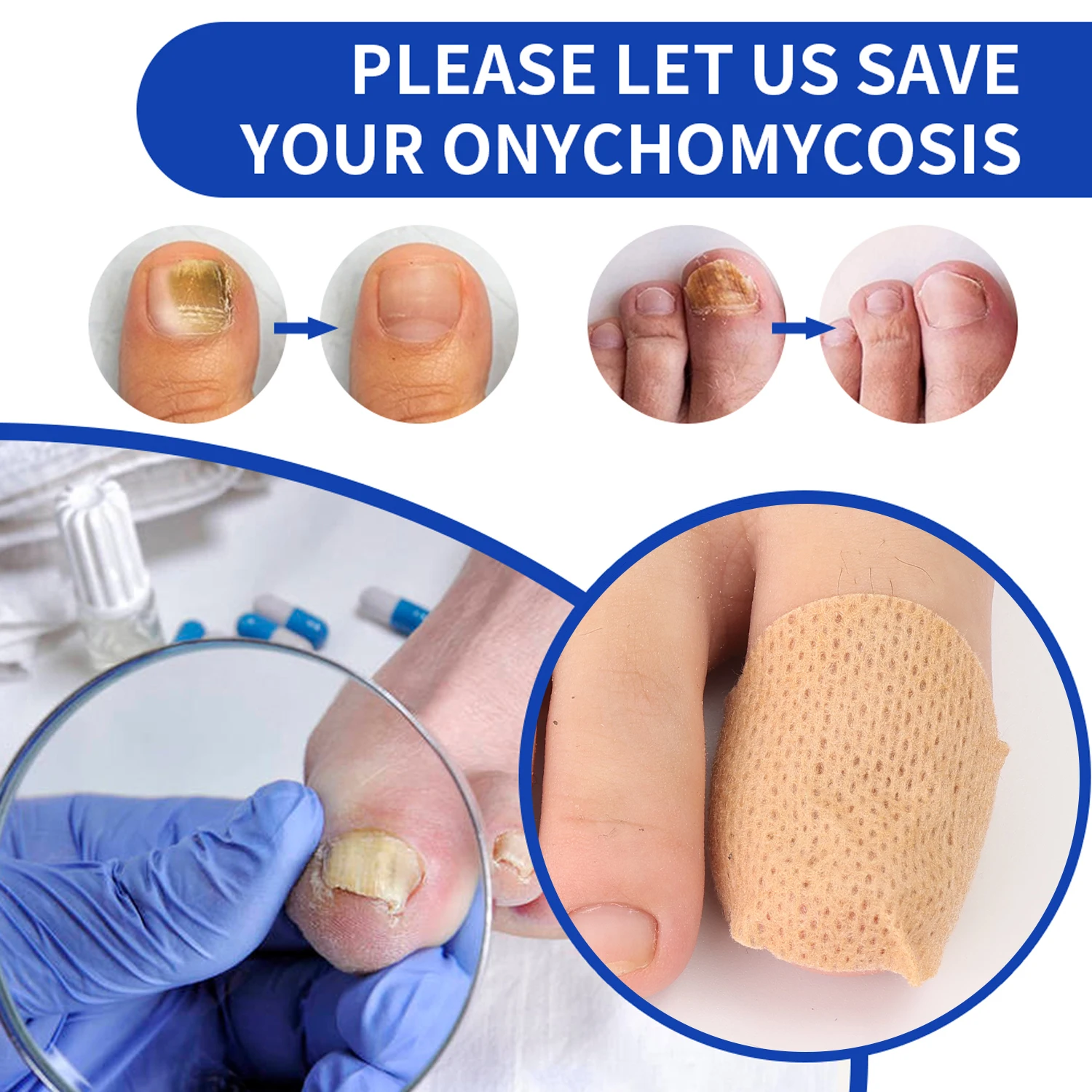 21/210PCS Nail Repair Patches Toenail Fungus Patch Sticky Care Nail Ingrown Correction Sticker Paronychia Disposable Toe Patch thumbnail 6