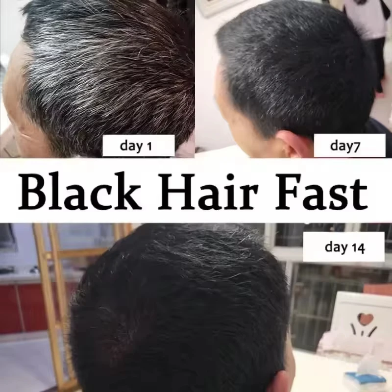 White hair killer, remove gray hair and restore natural hair color in 7 days thumbnail 4